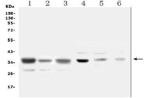 Western blot analysis of SFRP1 using anti-SFRP1 antibody (ABIN6719484).