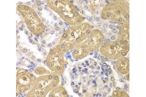 Immunohistochemistry of paraffin-embedded Rat kidney using AKR1A1 Polyclonal Antibody at dilution of 1:100 (40x lens). (AKR1A1 抗体)