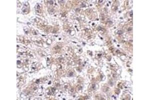 Immunohistochemistry of AFAP1L2 in human liver tissue with AFAP1L2 antibody at 2. (AFAP1L2 抗体  (C-Term))