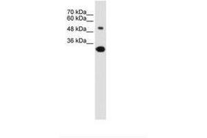 Image no. 1 for anti-Solute Carrier Family 2 (Facilitated Glucose/fructose Transporter), Member 5 (SLC2A5) (AA 300-349) antibody (ABIN6736628)