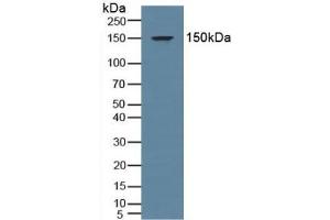 Detection of MR in Human Serum using Polyclonal Antibody to Mineralocorticoid Receptor (MR) (NR3C2 抗体  (AA 739-984))