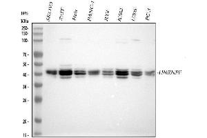 Western blot analysis of HnRNPF using anti-HnRNPF antibody (ABIN4886622).