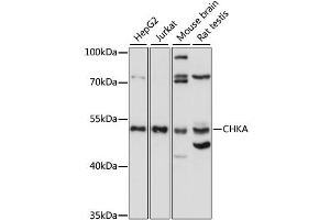 Western blot analysis of extracts of various cell lines, using CHKA antibody (ABIN6294191) at 1:1000 dilution. (Choline Kinase alpha 抗体)