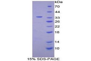 SDS-PAGE analysis of Mouse NB1 Protein. (CD177 蛋白)