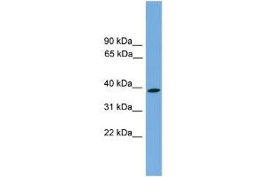 Western Blotting (WB) image for anti-Wingless-Type MMTV Integration Site Family, Member 3 (WNT3) (Middle Region) antibody (ABIN2783983)
