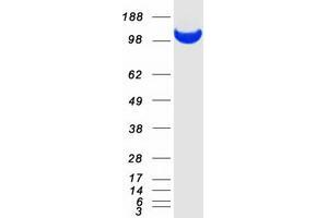 Western Blotting (WB) image for Adenosine Monophosphate Deaminase 2 (AMPD2) (Transcript Variant 2) protein (Myc-DYKDDDDK Tag) (ABIN2714667)