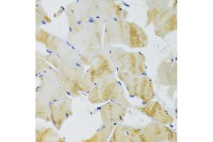 Immunohistochemistry of paraffin-embedded rat skeletal muscle using TRAP1 Antibody (ABIN5971463) at dilution of 1/100 (40x lens). (TRAP1 抗体)