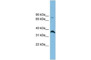 WB Suggested Anti-SLC6A15 Antibody Titration: 0. (SLC6A15 抗体  (Middle Region))