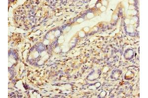 Immunohistochemistry of paraffin-embedded human small intestine tissue using ABIN7175449 at dilution of 1:100 (HSD17B12 抗体  (AA 40-181))
