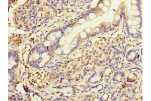 Immunohistochemistry of paraffin-embedded human small intestine tissue using ABIN7175449 at dilution of 1:100