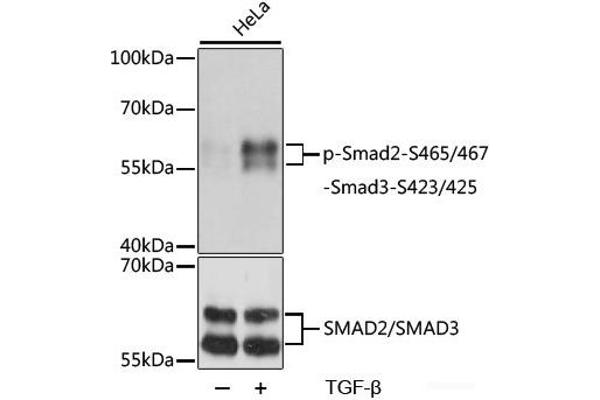 SMAD2 抗体  (pSer423, pSer425, pSer465, pSer467)