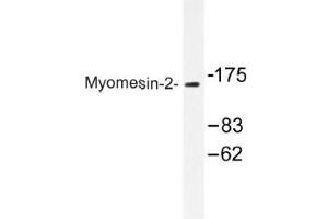 Image no. 1 for anti-Myomesin 2 (MYOM2) antibody (ABIN317920) (MYOM2 抗体)