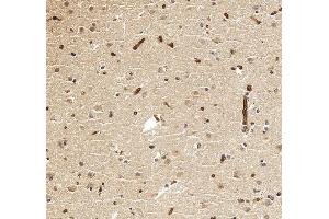 IHC analysis of CHAT using anti-CHAT antibody (ABIN7600920).