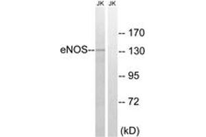Western blot analysis of extracts from Jurkat cells, treated with Insulin 0. (ENOS 抗体  (AA 1144-1193))