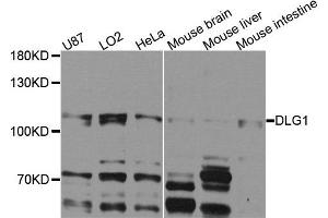 Western blot analysis of extracts of various cells, using DLG1 antibody. (DLG1 抗体)