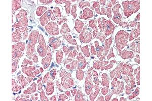 Anti-SLITRK6 antibody IHC of human heart. (SLITRK6 抗体  (Internal Region))