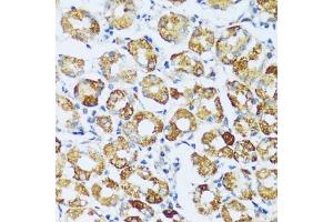 Immunohistochemistry of paraffin-embedded human stomach using C1QC antibody (ABIN7266475) at dilution of 1:100 (40x lens). (C1QC 抗体  (AA 50-150))