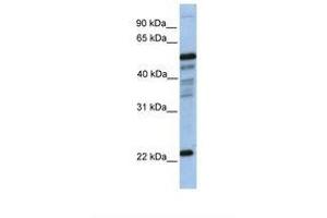 Image no. 1 for anti-Hematopoietic Prostaglandin D Synthase (HPGDS) (N-Term) antibody (ABIN6738498) (HPGDS 抗体  (N-Term))
