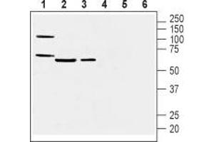Western blot analysis of mouse heart membranes (lanes 1 and 4), mouse lung lysate (lanes 2 and 5) and rat lung membranes (lanes 3 and 6): - 1-3. (Prostacyclin Receptor 抗体  (3rd Extracellular Loop))