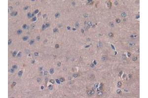 Detection of MCSF in Mouse Cerebrum Tissue using Polyclonal Antibody to Colony Stimulating Factor 1, Macrophage (MCSF) (M-CSF/CSF1 抗体  (AA 33-204))