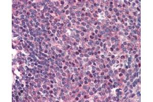 ABIN184957 (2µg/ml) staining of paraffin embedded Human Spleen. (CARD11 抗体  (C-Term))