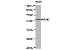 Western Blotting (WB) image for anti-P21-Activated Kinase 1 (PAK1) antibody (ABIN1874026) (PAK1 抗体)