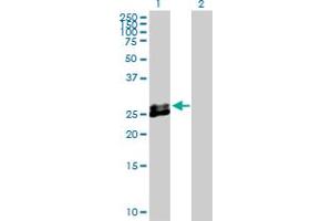 Western Blot analysis of EPDR1 expression in transfected 293T cell line by EPDR1 MaxPab polyclonal antibody. (EPDR1 抗体  (AA 1-224))
