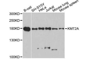Western blot analysis of extracts of various cell lines, using KMT2A antibody (ABIN5969854) at 1/1000 dilution. (MLL/KMT2A 抗体)