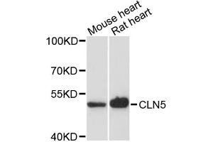 Western blot analysis of extracts of various cell lines, using CLN5 antibody. (CLN5 抗体)