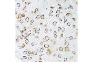 Immunohistochemistry of paraffin-embedded mouse brain using NOTCH2 antibody. (NOTCH2 抗体)