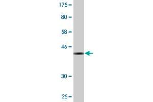 Western Blot detection against Immunogen (36. (ZNF34 抗体  (AA 104-203))