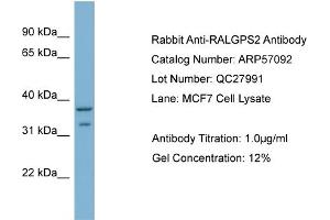 WB Suggested Anti-RALGPS2  Antibody Titration: 0. (RALGPS2 抗体  (C-Term))