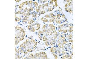 Immunohistochemistry of paraffin-embedded human stomach using TNFRSF10A antibody. (TNFRSF10A 抗体  (AA 269-468))