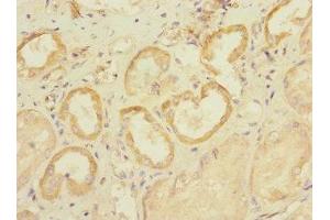 Immunohistochemistry (IHC) image for anti-Solute Carrier Family 28 (Sodium-Coupled Nucleoside Transporter), Member 1 (SLC28A1) (AA 1-80) antibody (ABIN7170032)