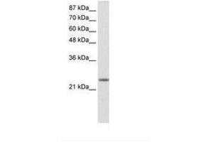 Image no. 1 for anti-MAX Dimerization Protein 3 (MXD3) (AA 40-89) antibody (ABIN202066) (MXD3 抗体  (AA 40-89))