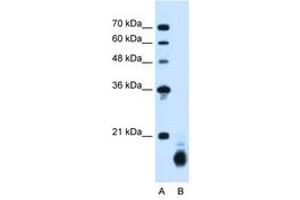 Image no. 2 for anti-Cyclophilin B (PPIB) (C-Term) antibody (ABIN205044) (PPIB 抗体  (C-Term))