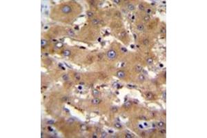 Immunohistochemistry analysis in formalin fixed and paraffin embedded human liver tissue reacted with PHF12 Antibody (C-term) followed which was peroxidase conjugated to the secondary antibody and followed by DAB staining. (PHF12 抗体  (C-Term))