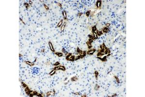 Anti-Kallikrein 1 antibody, IHC(P) IHC(P): Mouse Kidney Tissue (Kallikrein 1 抗体  (AA 25-261))