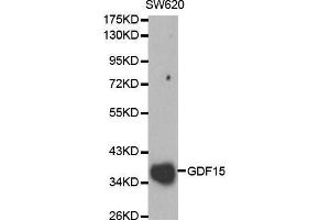 Western blot analysis of SW620 cell lysate using GDF15 antibody. (GDF15 抗体  (AA 49-308))