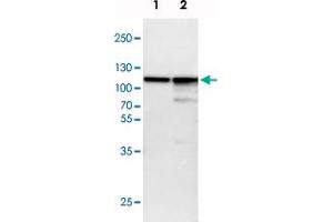 Western blot analysis of Lane 1: NIH-3T3 cell lysate (Mouse embryonic fibroblast cells), Lane 2: NBT-II cell lysate (Rat Wistar bladder tumour cells) with ACTN4 polyclonal antibody  at 1:100-1:500 dilution. (alpha Actinin 4 抗体)
