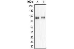 Western blot analysis of NPAS2 expression in HeLa (A), HepG2 (B) whole cell lysates. (NPAS2 抗体  (Center))