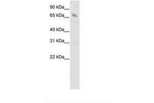 Kelch-like protein 41 (KLHL41) (C-Term) 抗体