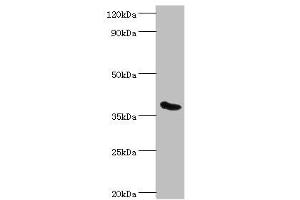 Western blot All lanes: Phytanoyl-CoA dioxygenase, peroxisomal antibody at 3 μg/mL + Mouse liver tissue Secondary Goat polyclonal to rabbit IgG at 1/10000 dilution Predicted band size: 39, 28 kDa Observed band size: 39 kDa (PHYH 抗体  (AA 1-338))