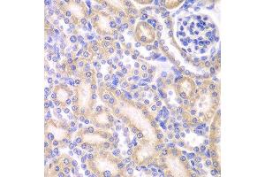 Immunohistochemistry (IHC) image for anti-Adenylate Kinase 4 (AK4) (AA 1-223) antibody (ABIN3022790) (AK4 抗体  (AA 1-223))