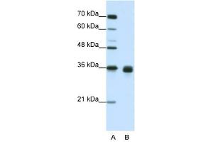 WNT2B antibody used at 1. (WNT2B 抗体  (Middle Region))