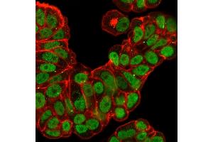 Immunofluorescence Analysis of PFA-fixed MCF-7 cells labeled with FOXA1 Rabbit Recombinant Monoclonal Antibody (FOXA1/2230R), followed by goat anti- rabbit IgG- CF488. (Recombinant FOXA1 抗体  (AA 372-472))