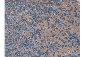 Detection of CA2 in Rat Spleen Tissue using Polyclonal Antibody to Carbonic Anhydrase II (CA2) (CA2 抗体  (AA 1-260))