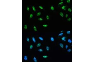 Immunofluorescence analysis of U-2 OS cells using DHX9/RNA Helicase Aantibody (ABIN7265748) at dilution of 1:100. (DHX9 抗体)