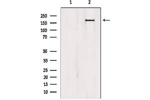 Western blot analysis of extracts from HepG2, using PTPN23 antibody. (PTPN23 抗体  (C-Term))