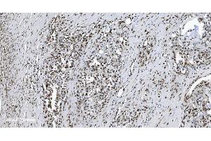 IHC analysis of SAMHD1 using anti-SAMHD1 antibody (ABIN7601514).